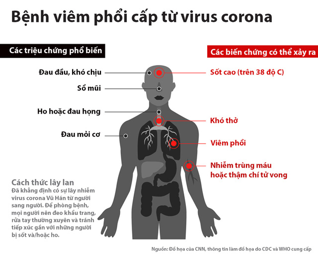 Các triệu chúng của bệnh viêm phổi cấp từ virus corona