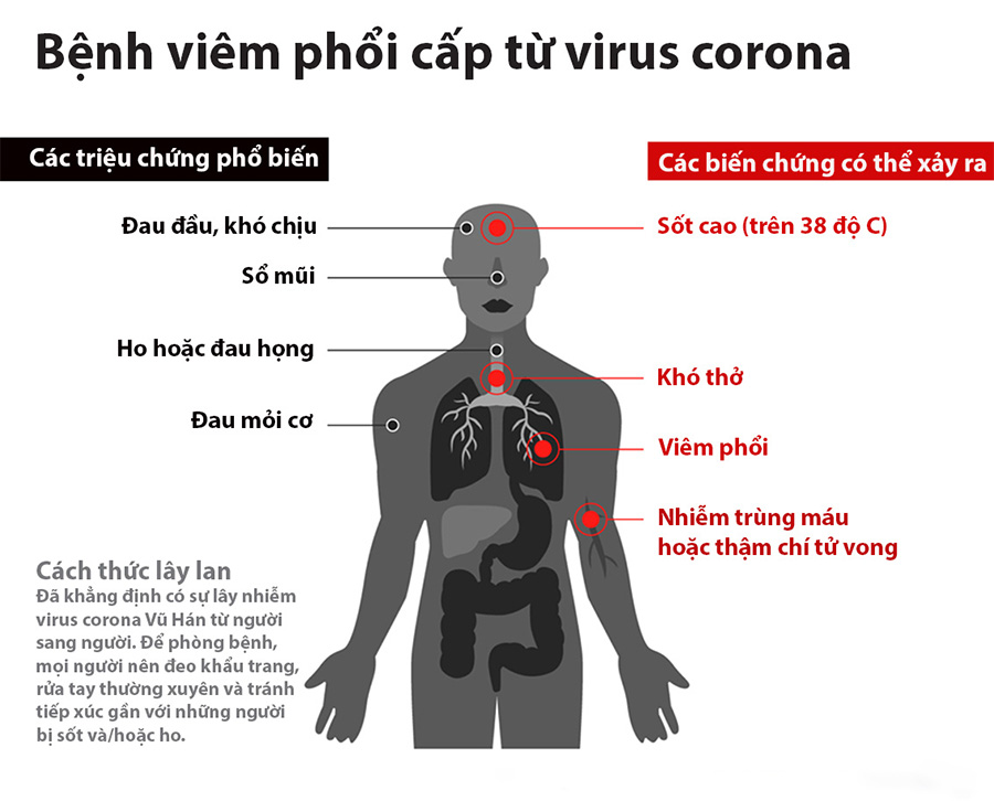 Triệu chứng của bệnh viêm phổi cấp do virus Corona gây ra